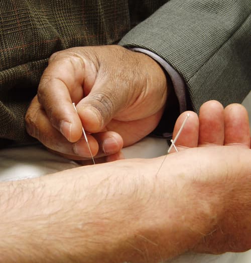 Acupuncture near Fort Mill and Indian Trail