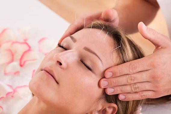 How to Build a Stress-Relief Routine with Acupuncture