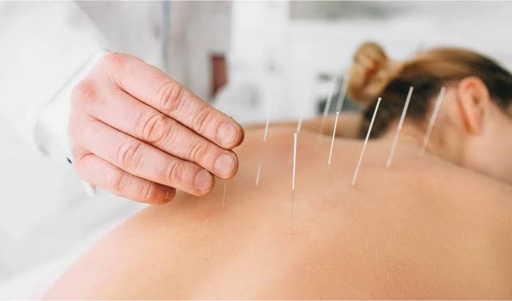 Charlotte, NC Acupuncture for Fall Allergies: What to Know